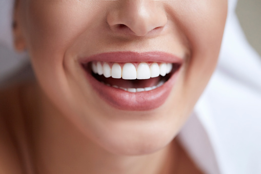 close up of someone's gorgeous smile after whitening