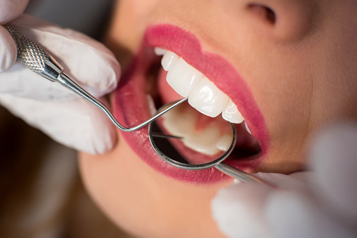 Person getting their teeth examined at Singing River Dentistry.