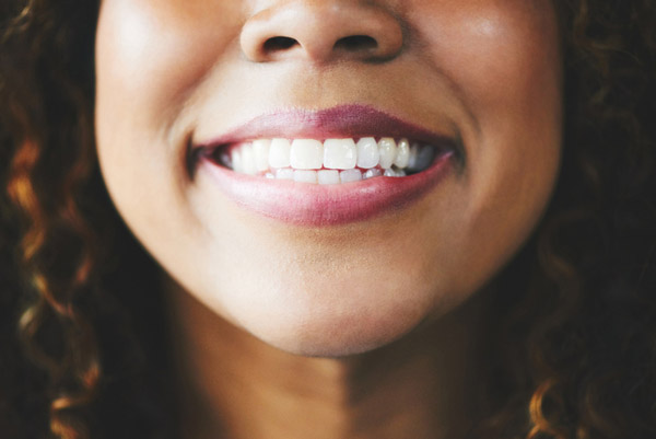  Close up of a beautiful woman smiling after getting dental implants at Singing River Dentistry in Tuscumbia, AL 