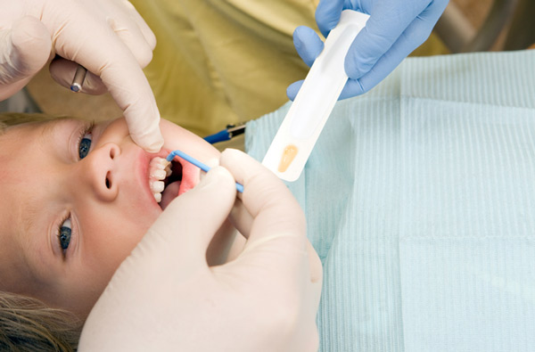 Young boy receiving fluoride treatment at Singing River Dentistry.