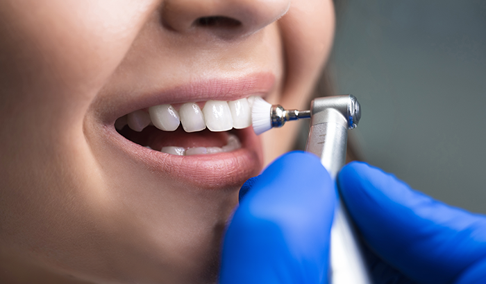 patient getting a professional in office whitening treatment