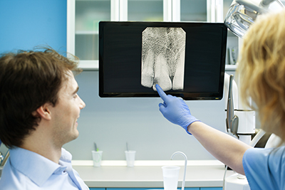 Panoramic X-rays Provide More Detail Than Traditional X-rays