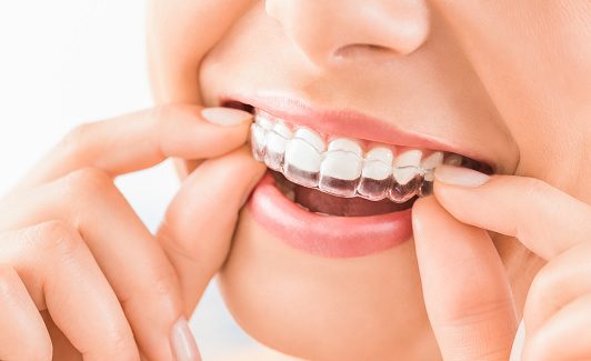 Night guard being placed in person's mouth